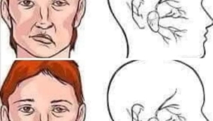 İnme (Felç) geldiğinde yapılacak ufak bir hareket felç olmaktan kurtarabilir... 