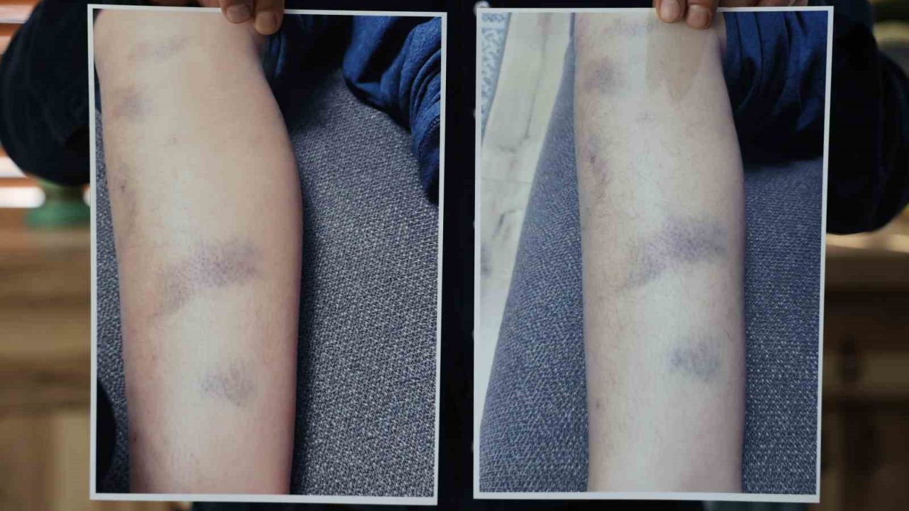 Diyarbakır’da özel okulda 8 yaşındaki çocuğun darbedildiği iddiası