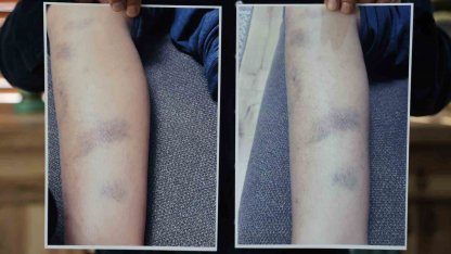 Diyarbakır’da özel okulda 8 yaşındaki çocuğun darbedildiği iddiası