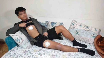 Akran zorbalığı az kalsın öldürüyordu: Önce dövüldü sonra bıçaklandı
