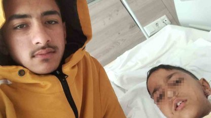 Ankara’da sokak köpeğinin saldırısına uğrayan çocuk yaralandı