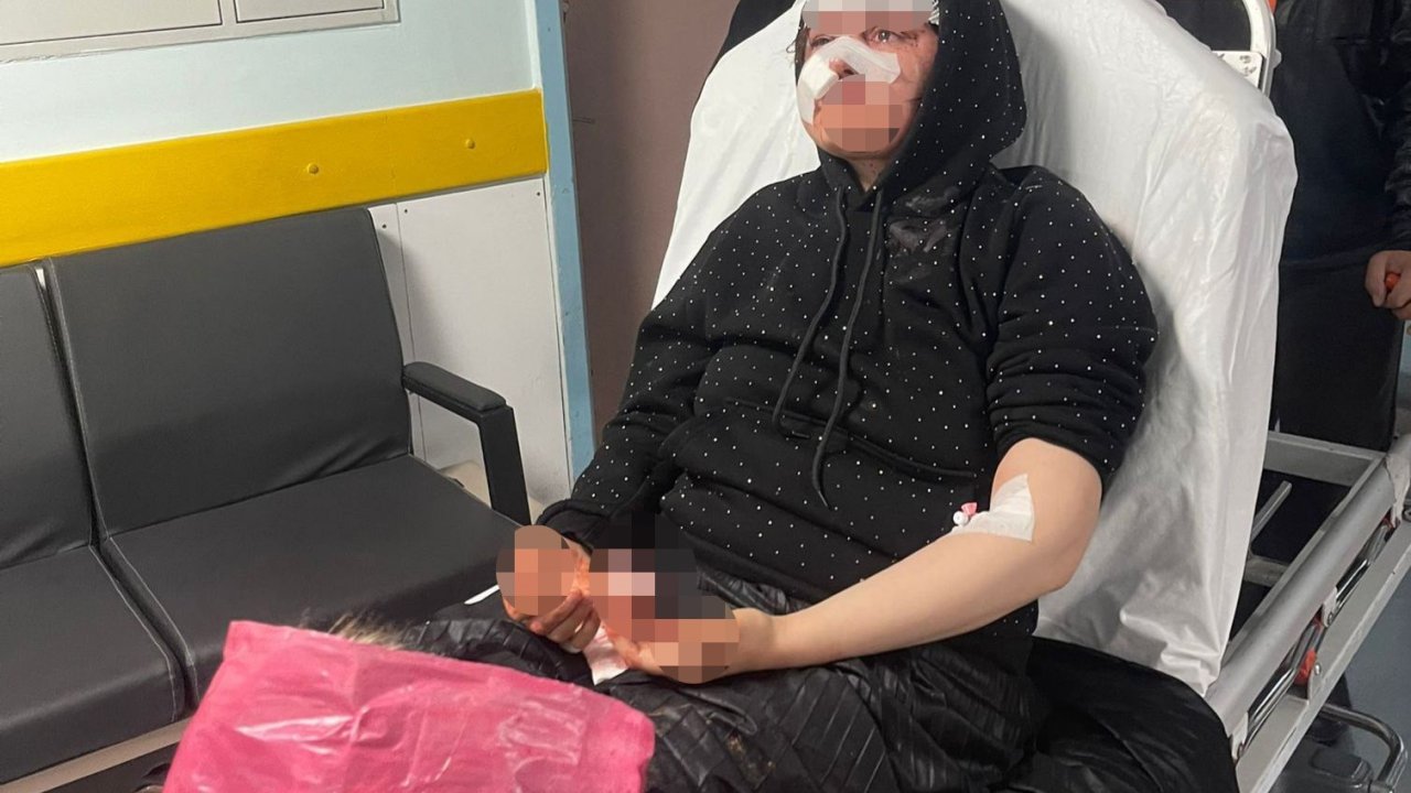 Boşanmak isteyen kadın eşi tarafından öldüresiye darp edildi