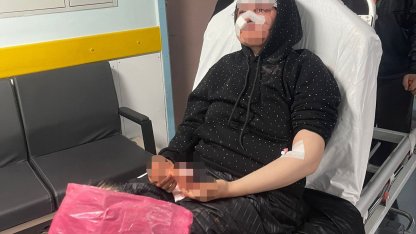 Boşanmak isteyen kadın eşi tarafından öldüresiye darp edildi