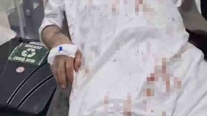 Şanlıurfa’da 72 yaşındaki adamı öldüresiye döven 4 şüpheli tutuklandı