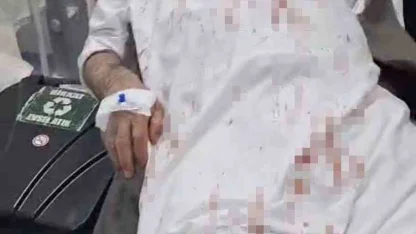 Şanlıurfa’da 72 yaşındaki adamı öldüresiye döven 4 şüpheli tutuklandı