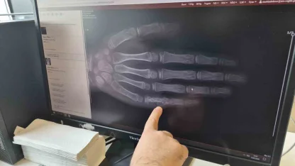 Eskişehir’de her ay 5 ila 7 çocuğa kanser tanısı konuluyor