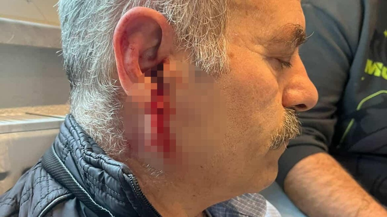 Silivri’de özel bakım merkezine çağrılan eski çalışan darbedildi