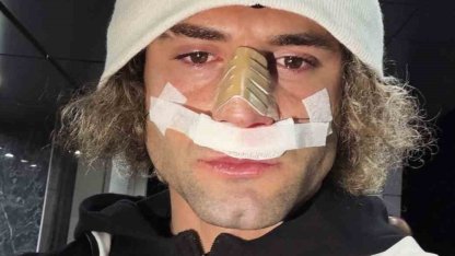 Elazığspor’da Fuat Bavuk’un burnu kırıldı