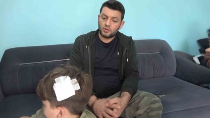 Yalova’daki komşu kavgasında bu kez 8 yaşındaki çocuğa taşlı saldırı