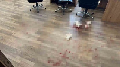 Yozgat’ta okul müdürünü darbeden saldırgan tutuklandı