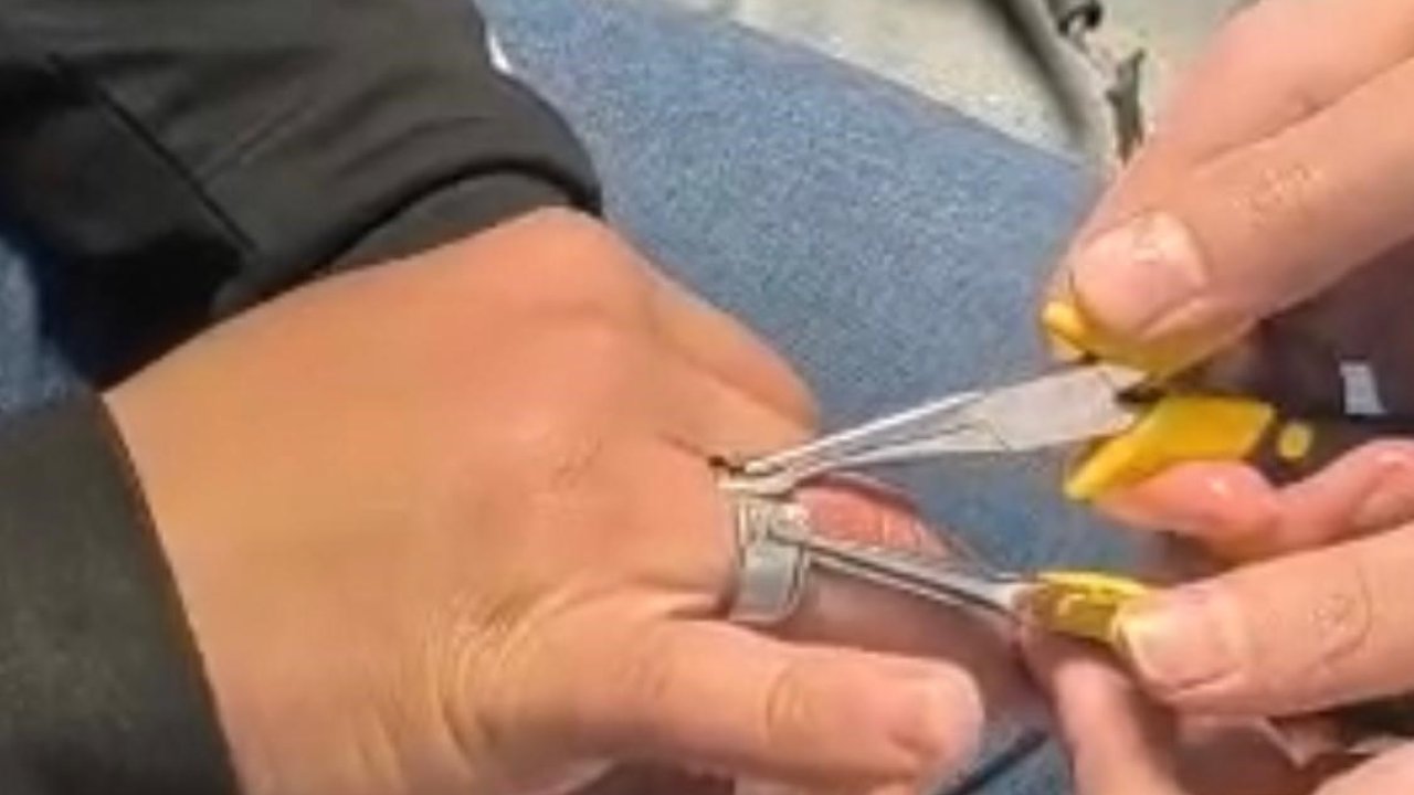 Batman’da parmağa sıkışan yüzük itfaiye ekiplerince çıkarıldı