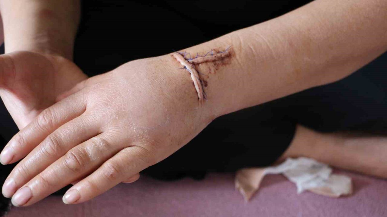 Diyarbakır’da dehşet: Nikahlı eşini 30 yerinden bıçakladı