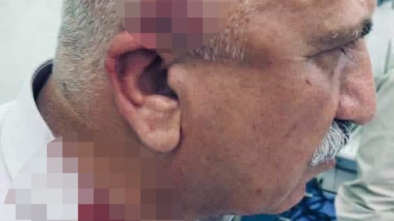 Kerkük’te kaçak yapı yıkımı sırasında kaymakama bıçaklı ve sopalı saldırı