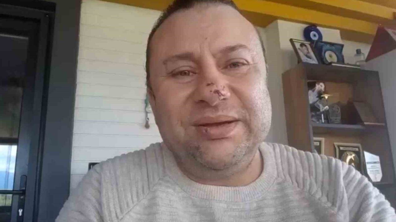 Pitbull saldırısına uğrayan Onur Akay o anları anlattı: "Ben ölümden döndüm"